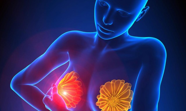 Kazakh surgical oncologists develop breast reconstruction method after surgery